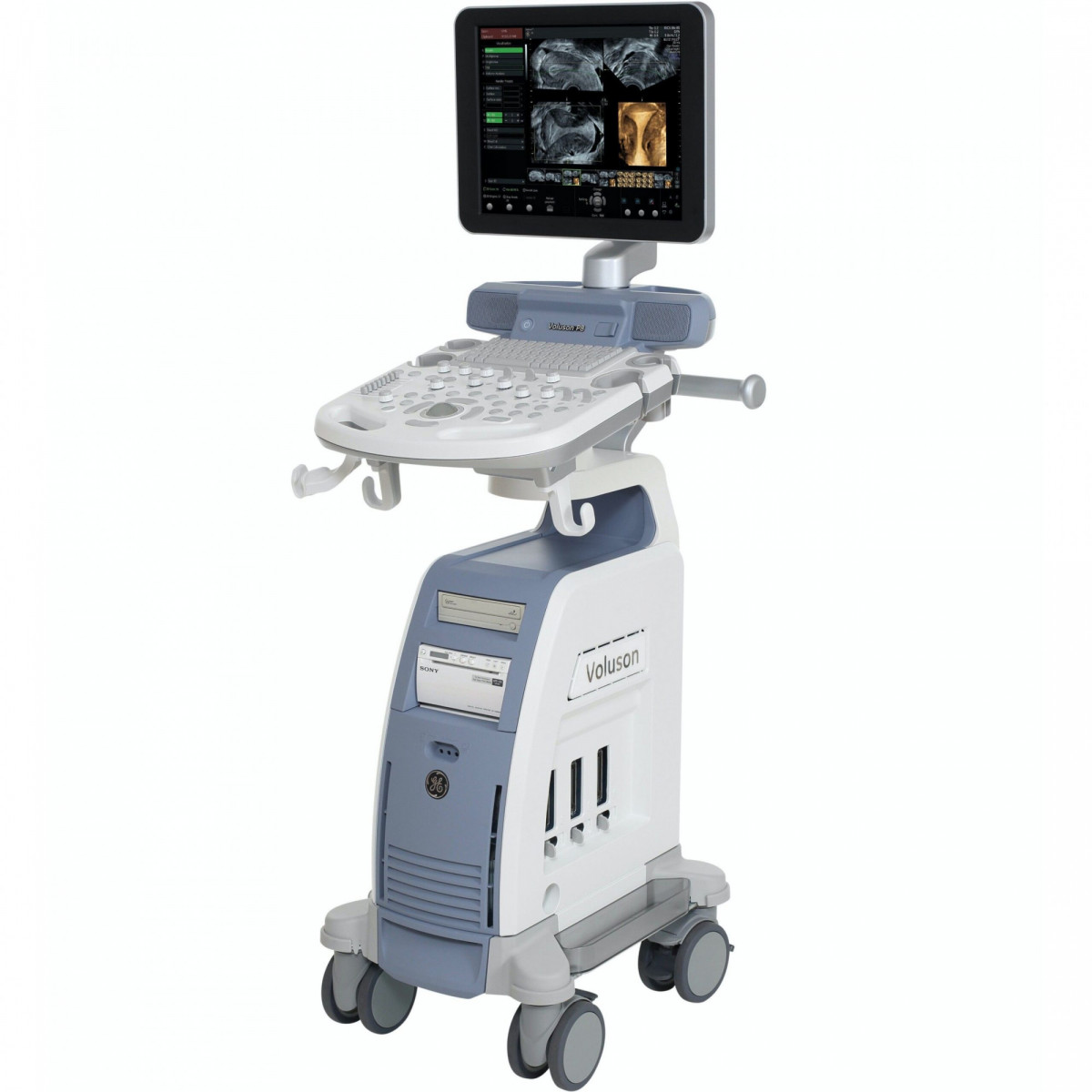 УЗИ аппарат GE Healthcare Voluson P8