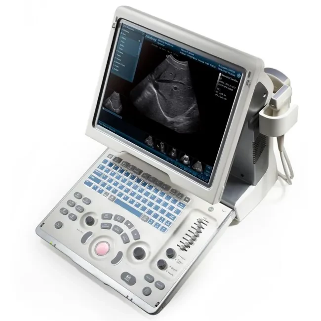 УЗИ аппарат Mindray DP-50 Color