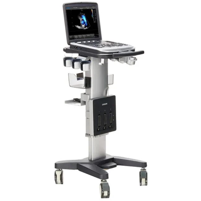 УЗИ аппарат Chison SonoTouch 80 (SonoBook 6)