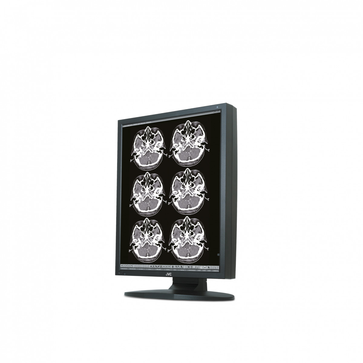 Медицинский монитор JVC MS25i2